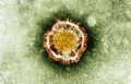 英健康保護局（Health Protection Agency、HPA）が公開した新型コロナウイルスの顕微鏡写真（撮影日不明）。(c)AFP/BRITISH HEALTH PROTECTION AGENCY
