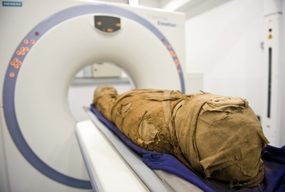 古代のミイラにも動脈硬化、米・エジプト研究結果