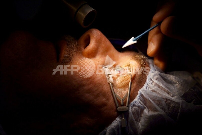 息子の歯で人工角膜移植、アイルランド男性が視力回復