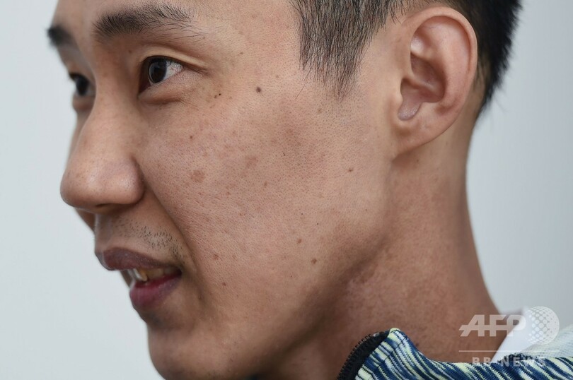 リー・チョンウェイ、「夢」の東京五輪目標に現役続行 がん治療終える