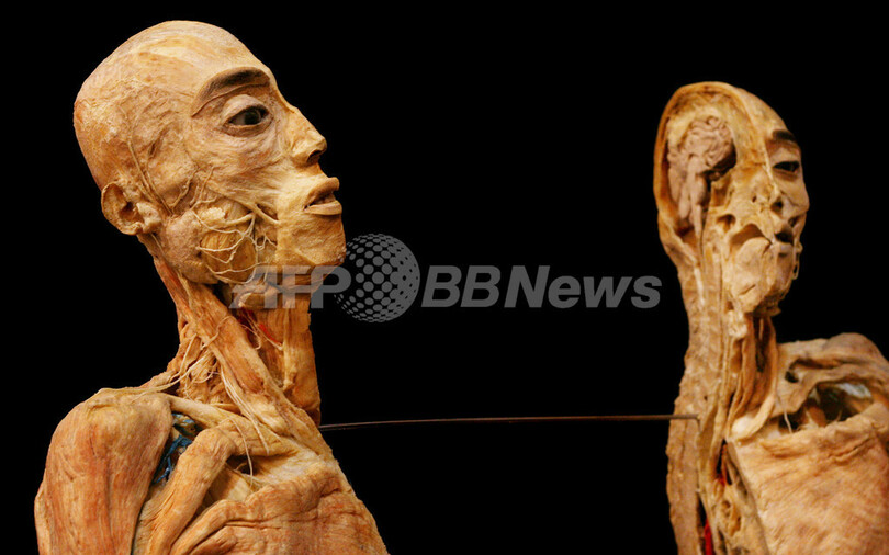 メルボルンで実物の人体標本展