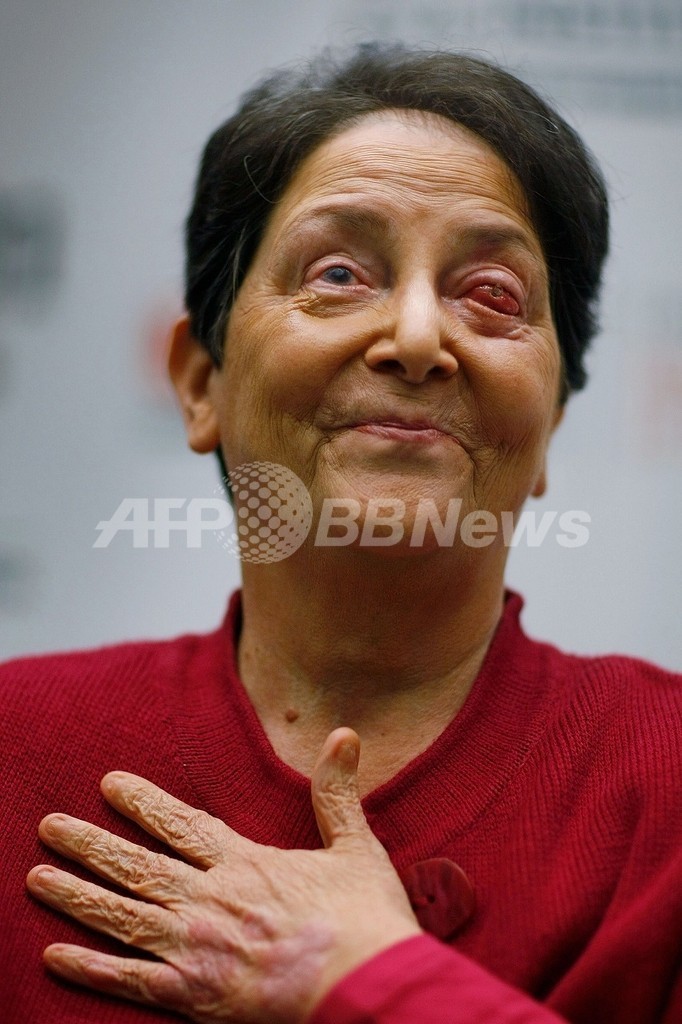 自分の歯を目に移植 失明から視力回復 米女性 写真6枚 国際ニュース Afpbb News 自分の歯を目に移植 失明から視力回復 米女性 写真6枚 国際ニュース Afpbb News