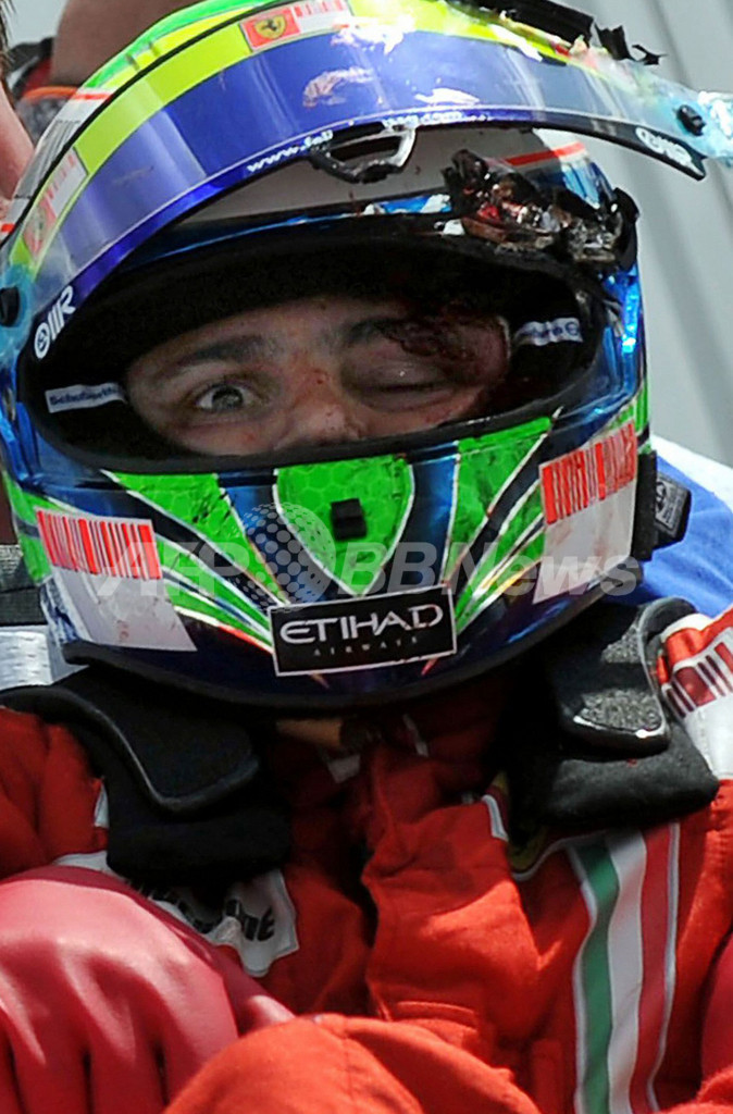 マッサの人工昏睡が維持される中、事故調査が開始