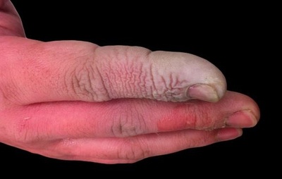 女性が誤ってフッ化水素酸に触れ死亡　中国杭州市