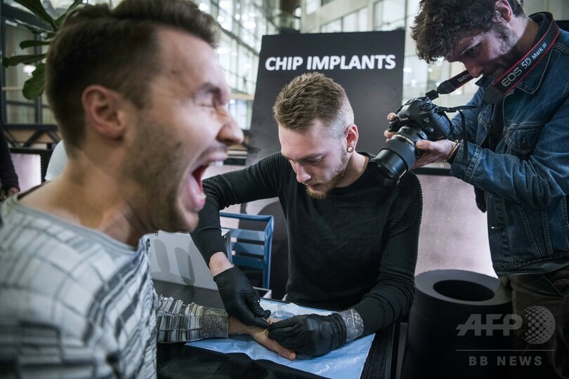 ハイテク好きなスウェーデン、マイクロチップの皮膚下移植進む