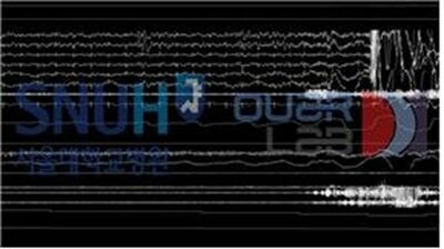 「浅い睡眠？深い睡眠？」どのレベルかAIが判定…韓国の研究グループ「判読アルゴリズム」開発