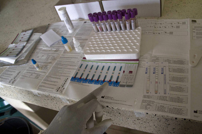 HIVの「隠れ家」、感染後早期に形成か 完治の希望弱まる