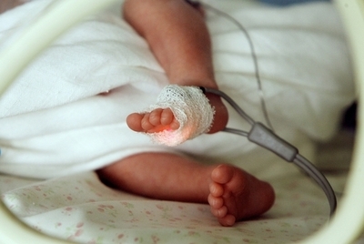 死亡宣告受けた未熟児、自宅で息を吹き返す パラグアイ