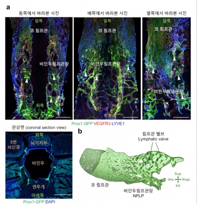 韓国の研究チーム、脳内老廃物を含む脳脊髄液の排出経路を発見…認知症予防研究のマイルストーン