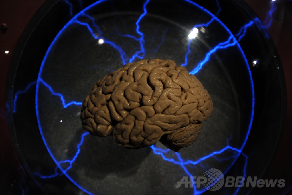 記憶を回復する脳インプラント、米軍研究が近日発表 記憶を回復する脳インプラント、米軍研究が近日発表