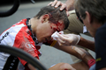 2011ツール・ド・フランス（2011 Tour de France）、第5ステージ（カルエクスからカプ・フレエル、164.5キロメートル）。レース中に落車し、治療を受けるチーム・レディオシャック（Team RadioShack）のヤネス・ブライコヴィッチ（Janez Brajkovic、スロベニア、2011年7月6日撮影）。(c)AFP/LIONEL BONAVENTURE