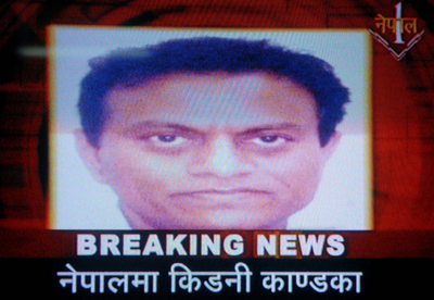 インド人医師、ネパールで拘束されインドに送還・違法臓器移植組織の首謀者