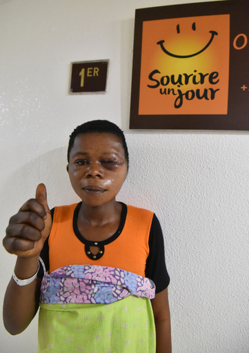 水がんで顔を失った患者たちに希望の光、コートジボワール