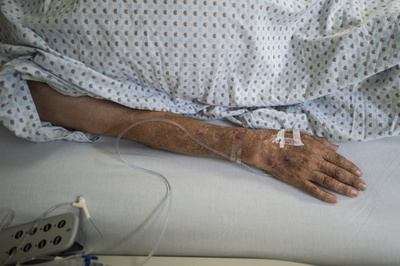 103歳女性、新型コロナから回復 メキシコ