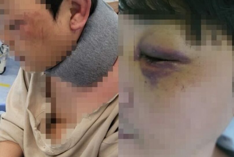 負傷した夫の様子（ボベドリームキャプチャー）(c)news1