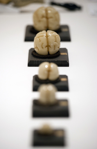 意地悪、それとも親切？ 性格と脳の形に関連性 研究