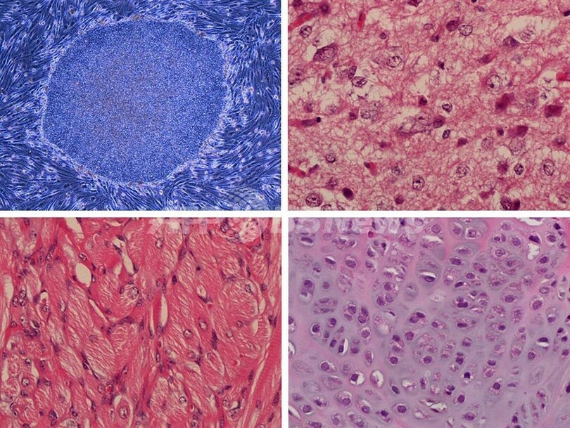 より安全なiPS細胞の作製に成功、英国とカナダの研究チーム