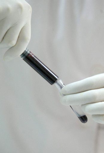 猛威をふるう「腸内寄生虫」 - アンゴラ