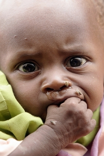 予防可能な病気で死亡する子どもは年間30万人、紛争国スーダン