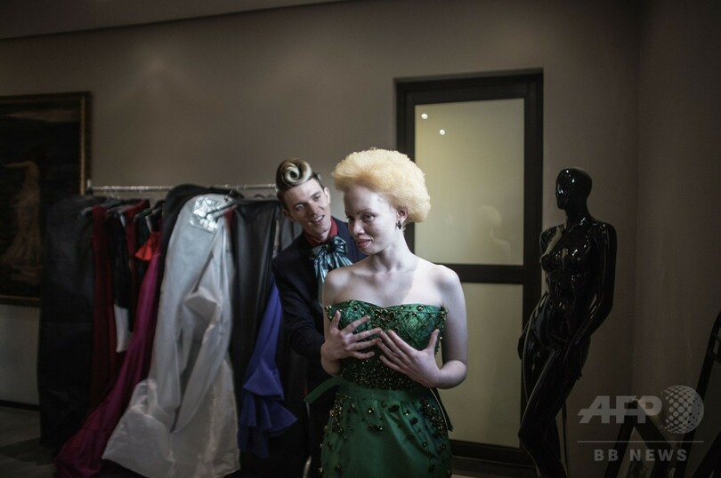 アルビノへの偏見乗り越えモデルに、南アのタンド・ホパさん