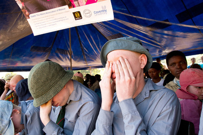 先天性色素欠乏症の6人が来年の選挙に立候補、マラウイ