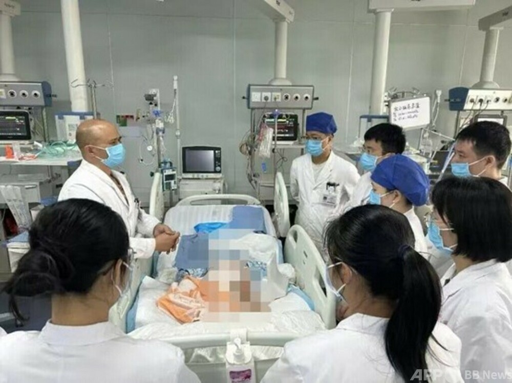キングコブラにかまれた女児 3日間の「仮死状態」から奇跡の生還＝中国