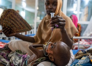 栄養失調に苦しむ子どもが増加 チャド