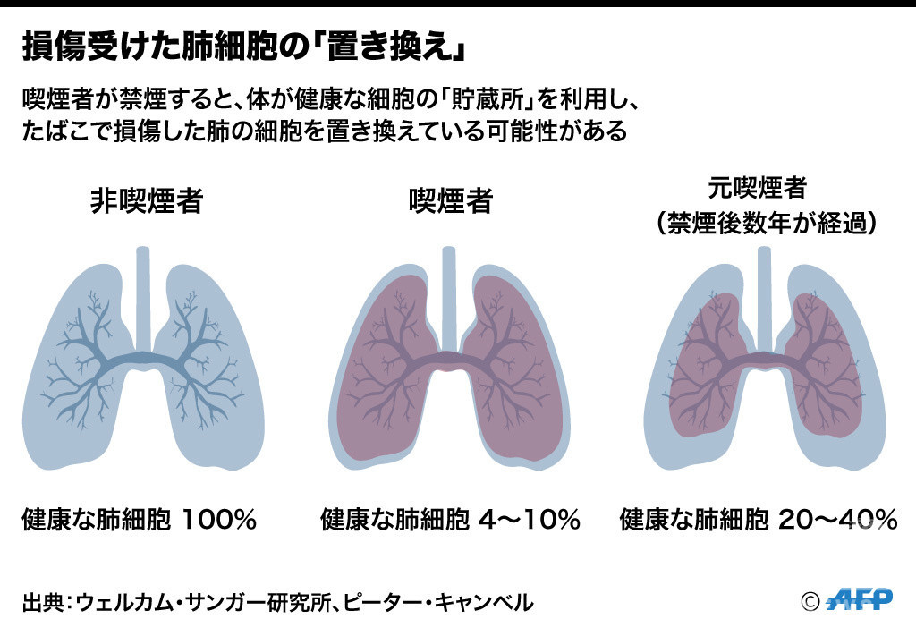 損傷受けた肺細胞の 置き換え 禁煙で促進か 研究 写真2枚 国際ニュース Afpbb News