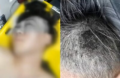 通行人を執拗に殴打、殺人未遂で29歳男2人に実刑判決…韓国・上半身裸で路上に放置される