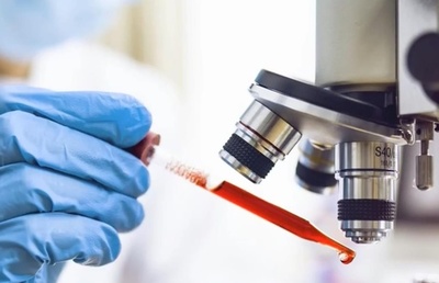 多国回答者の8割が「新型コロナ発生源調査問題は政治化」