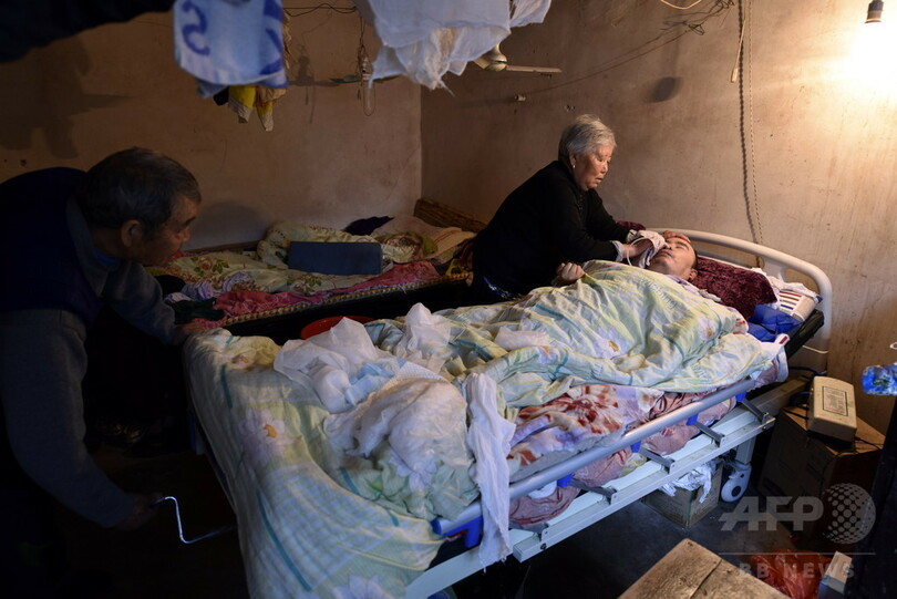 72歳母、植物状態の息子を14年間介護 山東