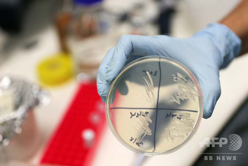 地球最古、10億年前の菌類発見 従来の認識塗り替えるか