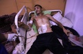 シリアの首都ダマスカス近郊の反体制派支配地区、東グータにある仮設の病院で、治療を受ける男性（2018年2月25日撮影）。(c)AFP PHOTO / AMER ALMOHIBANY