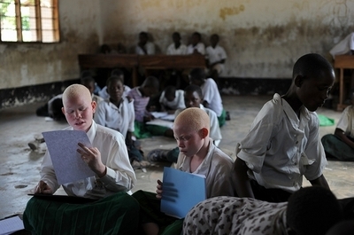 東アフリカ・ブルンジでまたアルビノ殺害事件、生きたまま手足を切断