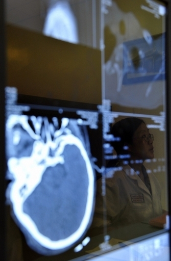 11歳の少女の頭部から針、男児偏重の弊害 中国