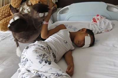 両目くりぬかれた男児、視力回復の可能性 眼科医が義眼無料移植申し出