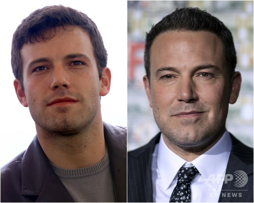 【特集】写真で振り返る海外セレブのビフォーアフター