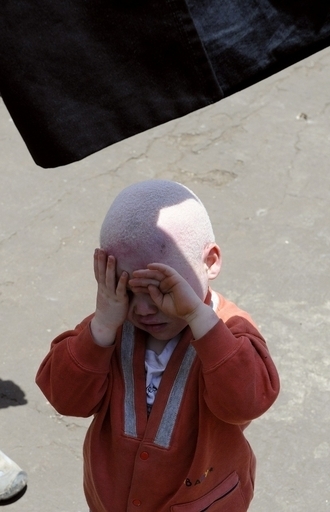 アルビノを初めて難民と認定、スペイン政府