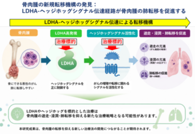 骨肉腫の「肺転移」を抑制するメカニズムを解明：骨肉腫の新規治療標的を発見