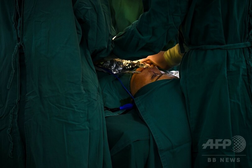 「欧米人みたいな鼻にしたい」 中国で美容整形ブーム