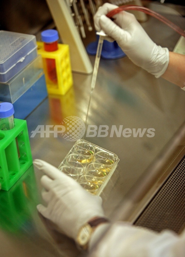 マウスの皮膚細胞から神経細胞を直接作製、iPS細胞使わず 米スタンフォード大 マウスの皮膚細胞から神経細胞を直接作製、iPS細胞使わず 米スタンフォード大