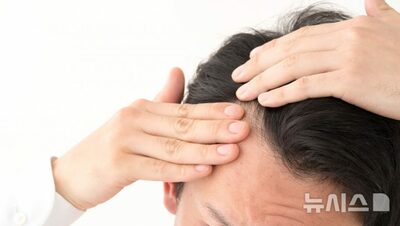恋も就活も不安に…韓国・20代男性を襲う脱毛の深刻な心理的影響