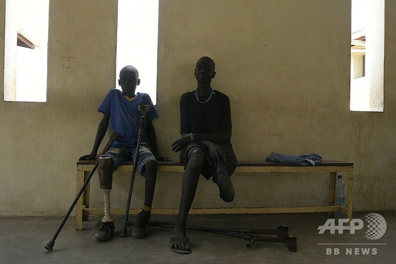 内戦で数万人が手足失い…全国から義肢求めて訪れる施設 南スーダン
