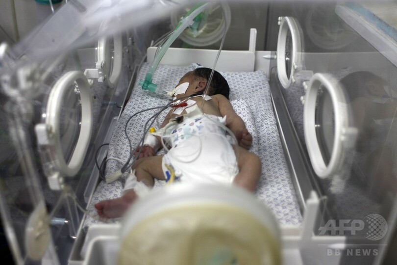 ガザ攻撃で死亡の妊婦から赤ちゃんを摘出