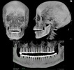 エジプトの妊婦のミイラのX線画像。ワルシャワ・マミー・プロジェクト提供（2015年撮影、2021年4月29日提供）。(c)AFP PHOTO / Warsaw Mummy Project