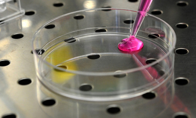 女性のがん遺伝子検査、受診機会失われる傾向に 米調査