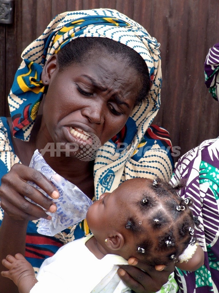 栄養失調児が700万人のナイジェリア 最大の要因は 迷信 写真1枚 国際ニュース Afpbb News
