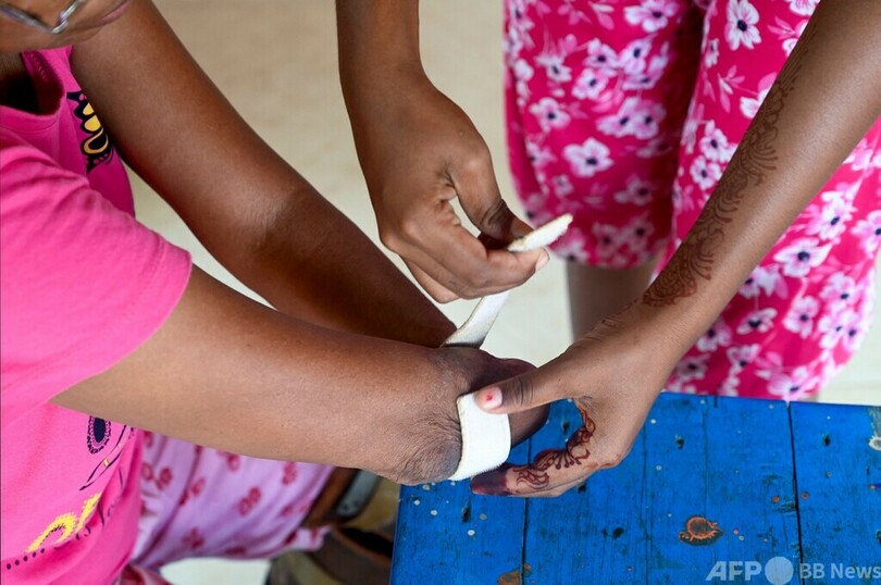 四肢を失った教師、教壇への復活遂げる インド