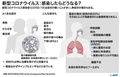 新型コロナウイルス感染症（COVID-19）の症状についてまとめた図解。(c)AFP