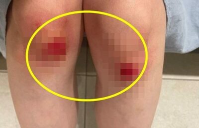 ランニングマシンをとめずに降りた高齢者、続いて乗って転倒した女性…韓国・双方の落ち度はいかに